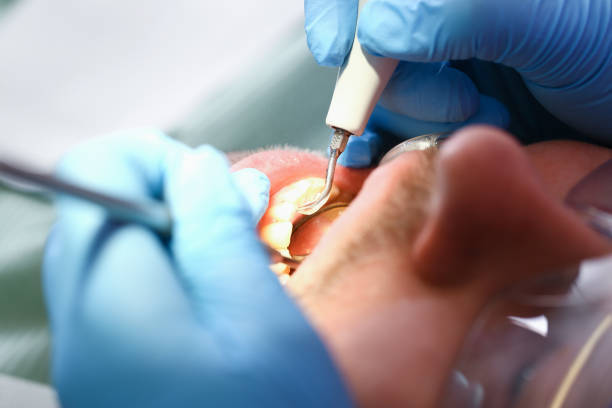 Best Pediatric Emergency Dentist in Gilbert, MN