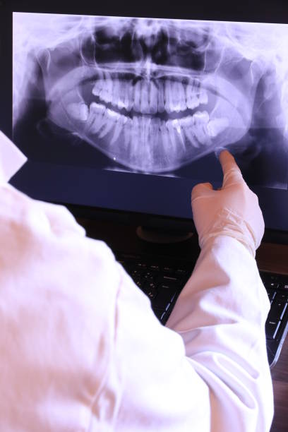 Best Emergency Dental Care for Broken or Chipped Teeth in Gilbert, MN