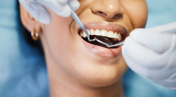 Best Emergency Root Canal Treatment in Gilbert, MN